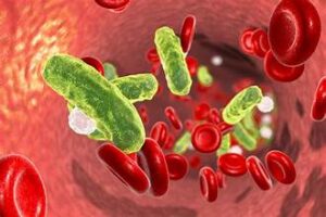 infections-300x200 Complications of IV Line in Neonates: Risks, Prevention, and Management